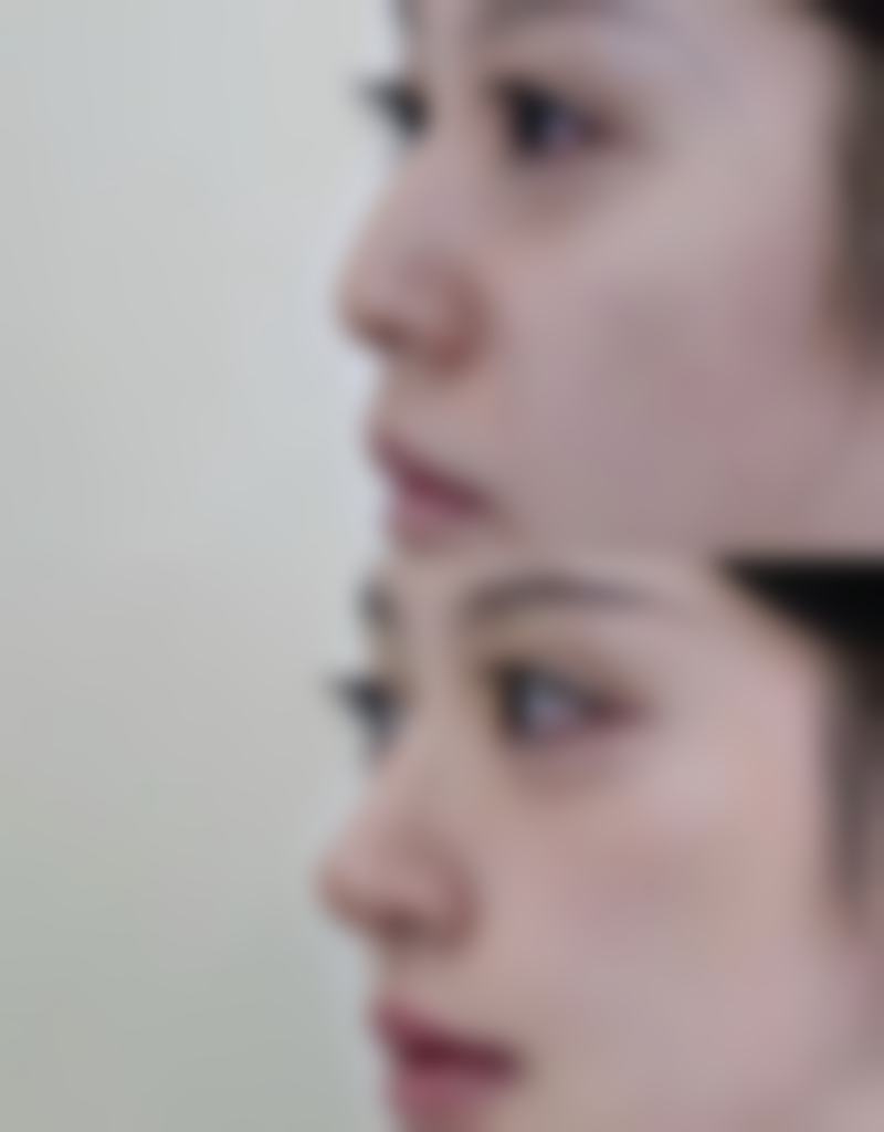 隆胸医生：打造理想胸部的能手