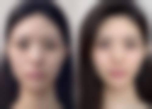 徐州亚韩医疗美容门诊部收费价格表