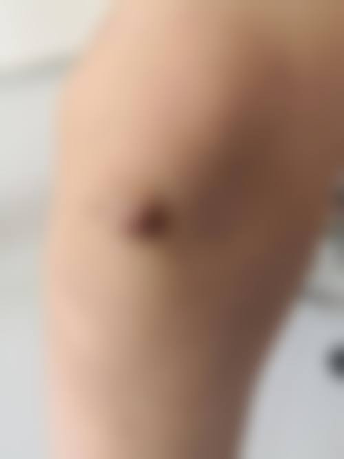 娄底德美医疗美容门诊部：院长领衔，技术不错