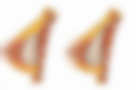 三、自体脂肪隆胸手术的修复特点
