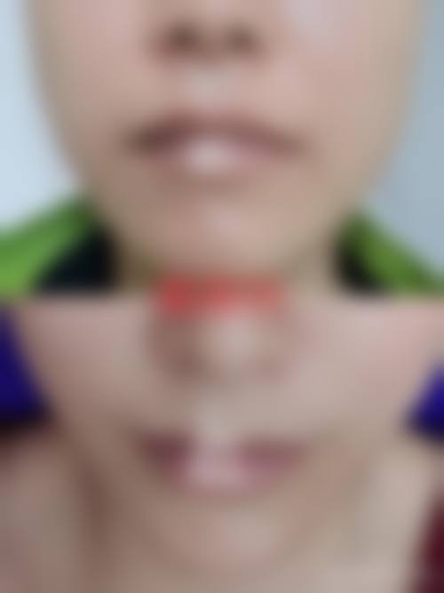 无锡佳加丽整形美容医院详细的预约挂号方式及流程