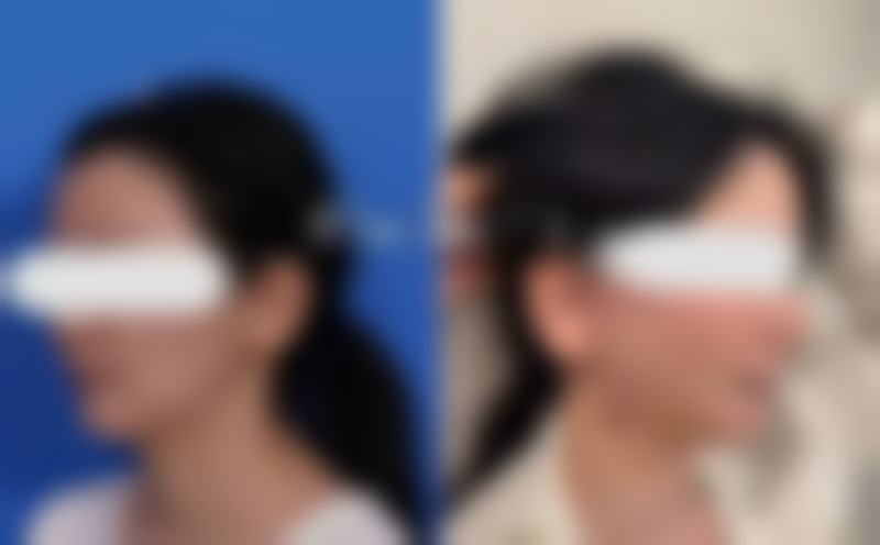 北京欧兰美整形医院患者口碑:真实评价+体验细节