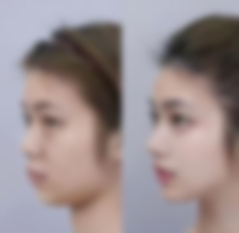 医学美容改善,应对明显疤痕问题
