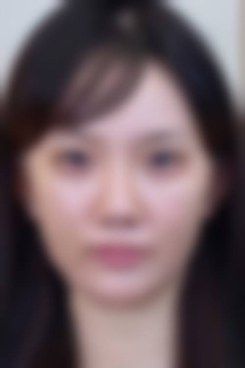 韩国melab皮肤科患者口碑与真实评价