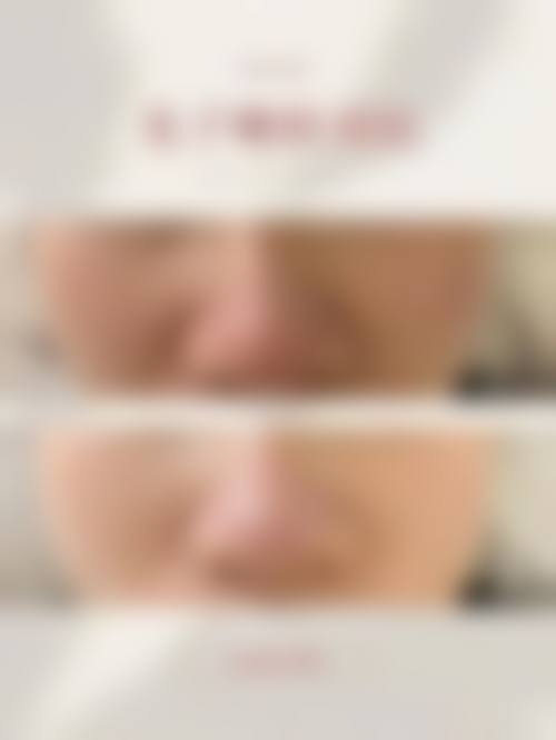 五、选择医院的注意事项