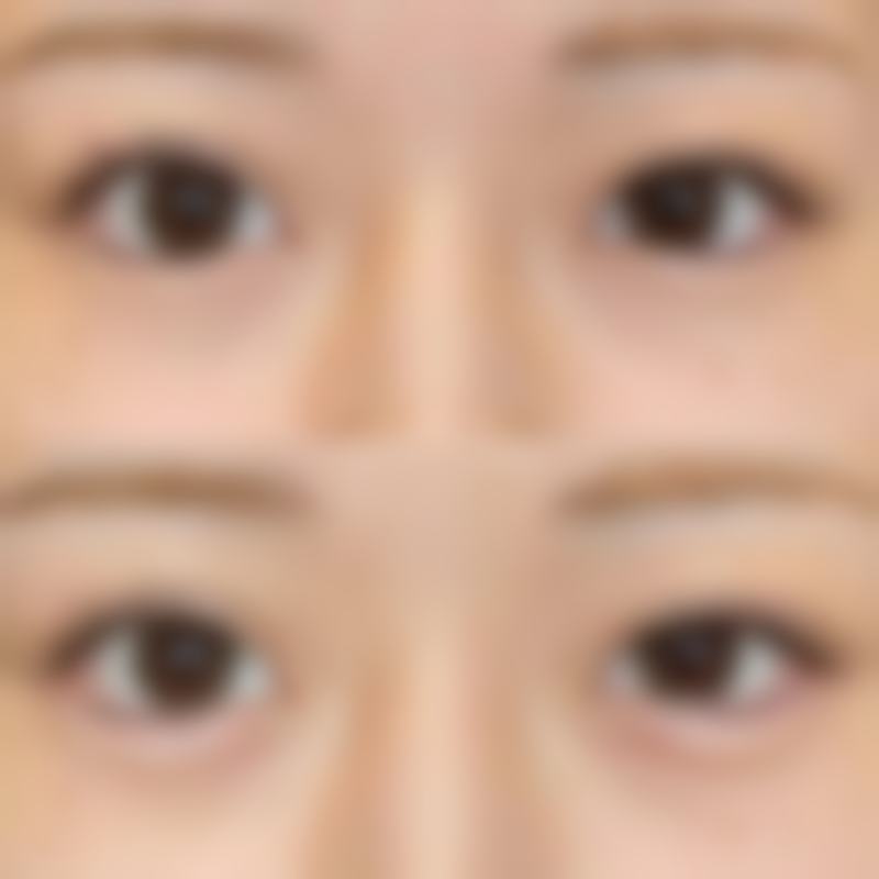 韩国melab皮肤科预约挂号方式