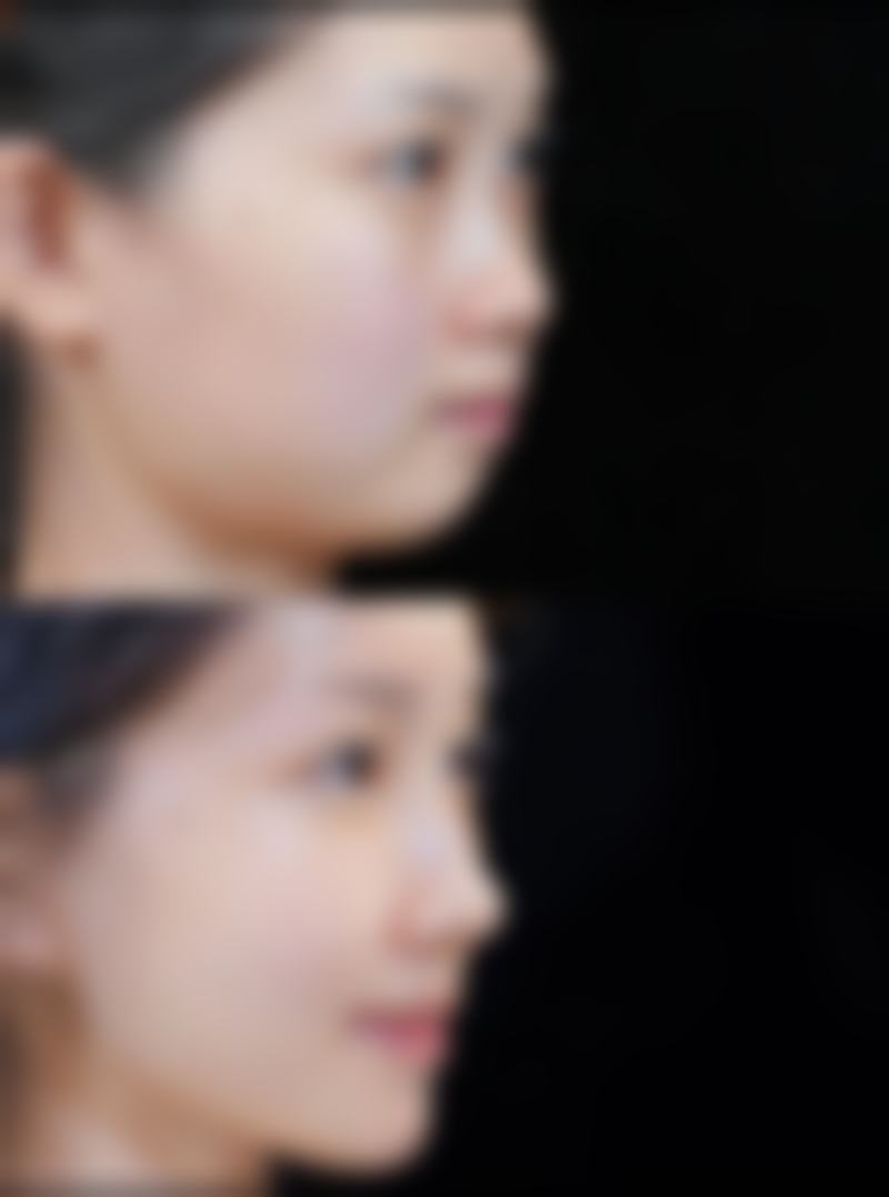 韩国melab皮肤科项目价格参考