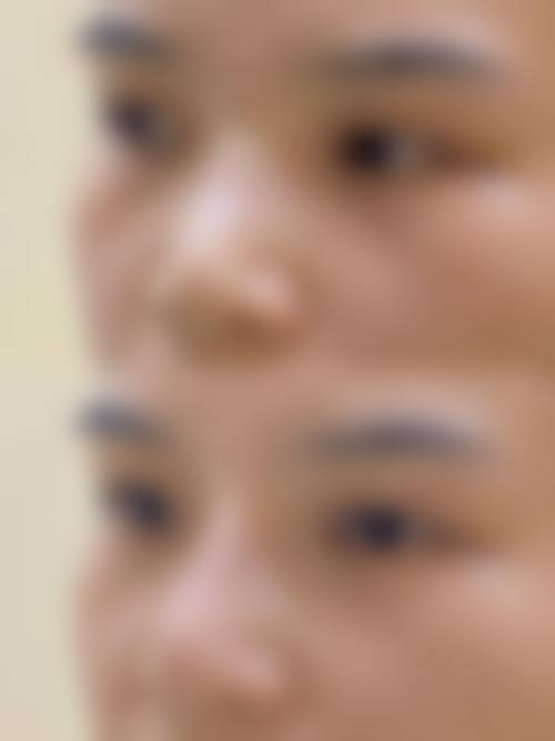 广西 南宁赫铂丽整形医院患者真实反馈回答口碑怎么样？