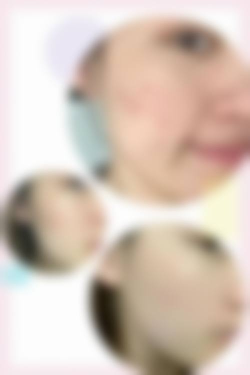 南通俪人医疗美容医院怎么样——患者满意度情况