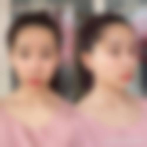南通俪人医疗美容医院怎么样——特色技术优势