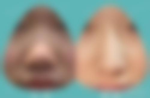 广西 南宁赫铂丽整形医院地址与预约挂号就诊指南