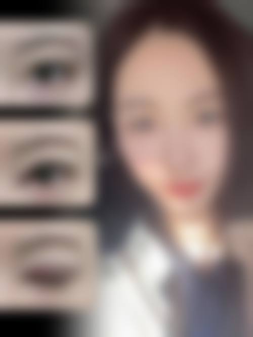 眼修复吕方中可信且靠谱之医生资历深厚