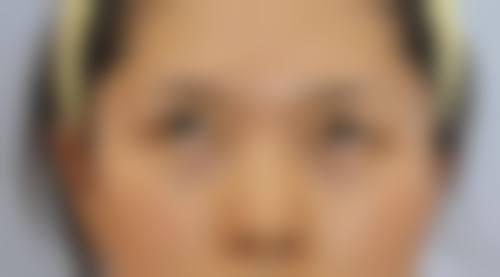 【南通蝶美莎医疗美容医院地址及交通路线】