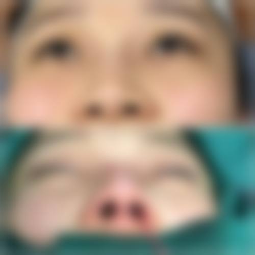 【南通蝶美莎医疗美容医院预约挂号方式】
