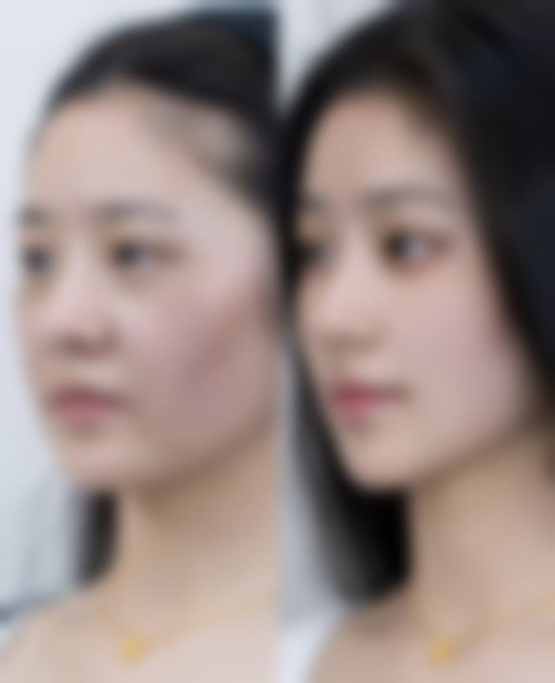 长沙晶肤医学美容医院，轻医美特色显著，激光祛斑1k元起，医生技术靠谱！ 
