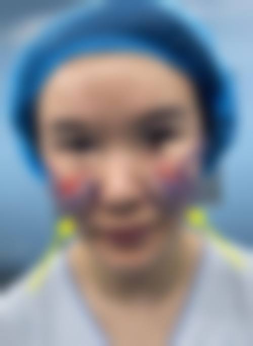 长沙医美:叶甄美独占鳌头