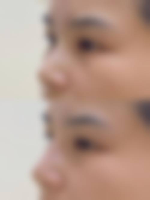 徐州矿务总医院整形美容中 心常见问题解答