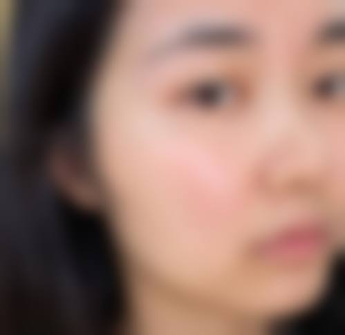 徐州矿务总医院整形美容中 心重点开展项目