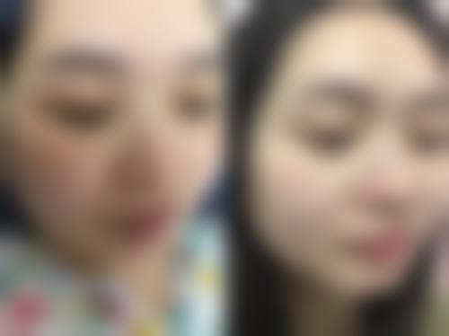深圳阳光医疗整形美容医院靠谱吗？医生经验足、项目多，口碑评价佳，值得信赖！ 