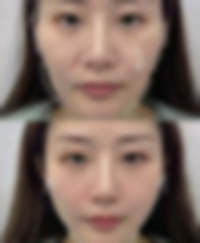 六、亳州莳月时光医疗美容诊所口碑怎么样?真人好评反馈