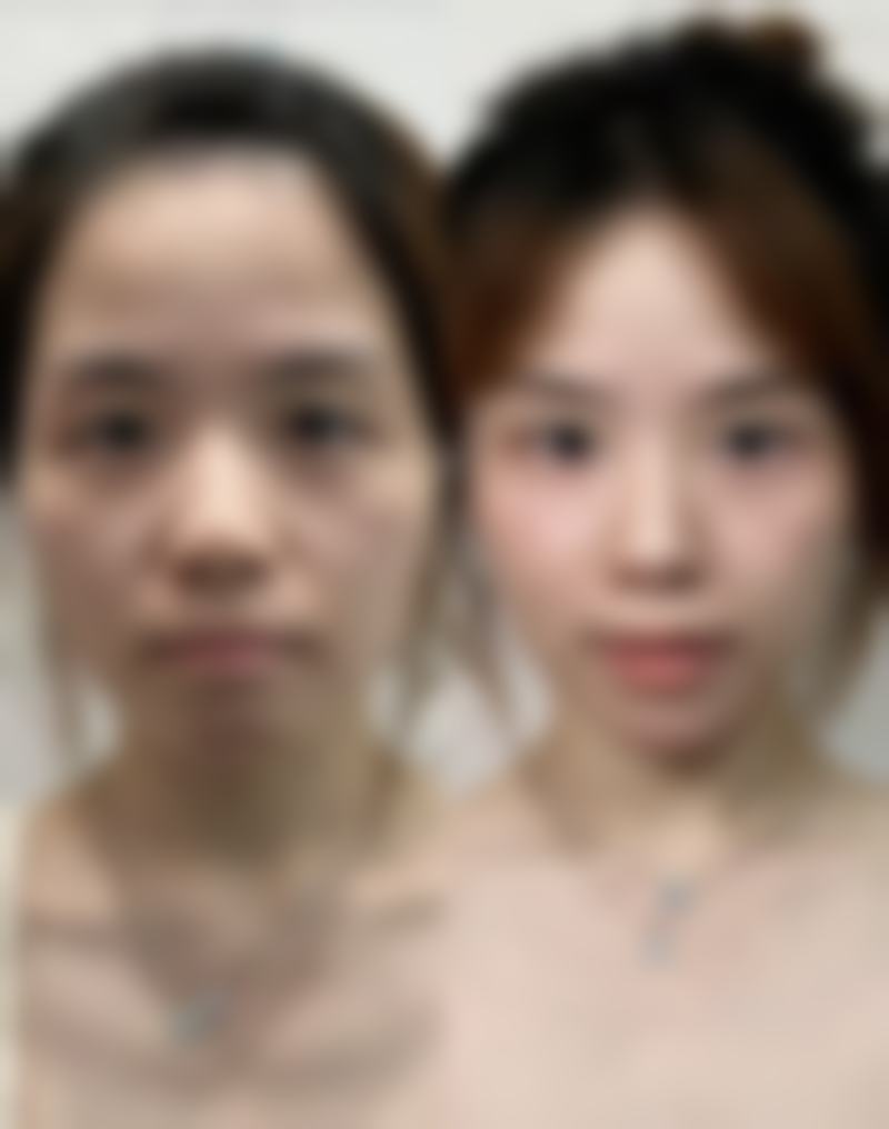 四、亳州莳月时光医疗美容诊所重点诊疗项目及技术优势