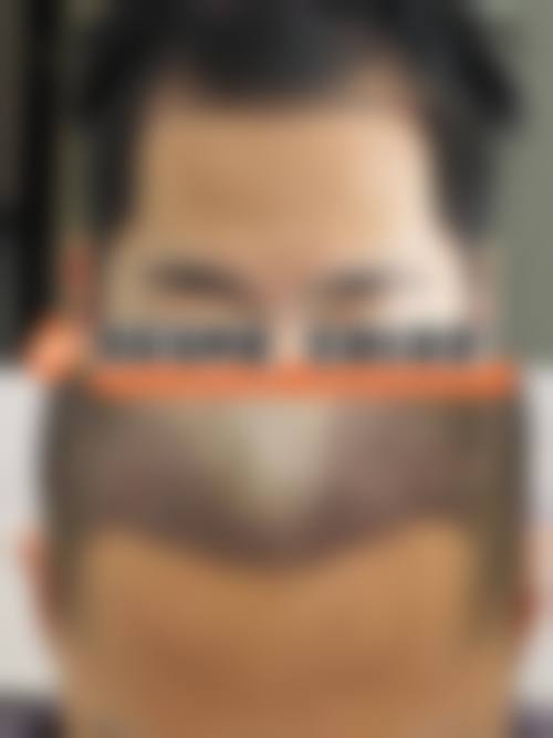 选择雍禾医院的建议