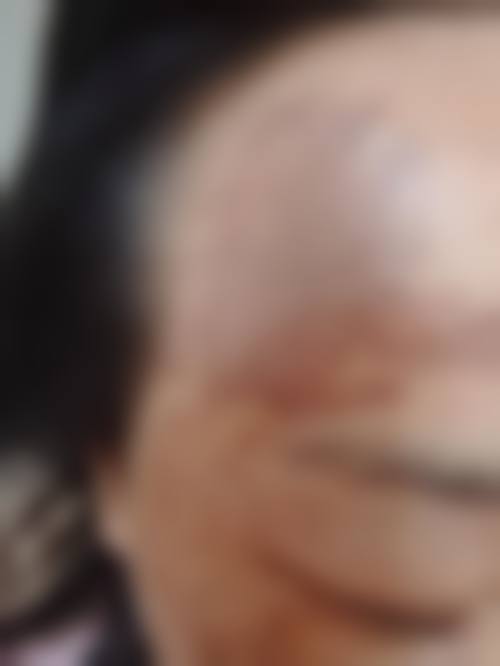 五、昆山第一人民医院的祛痣医生靠谱吗?
