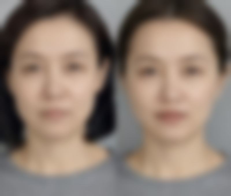 黄鑫彬医生怎么预约?