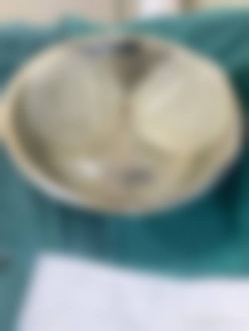 面部填充手术评价