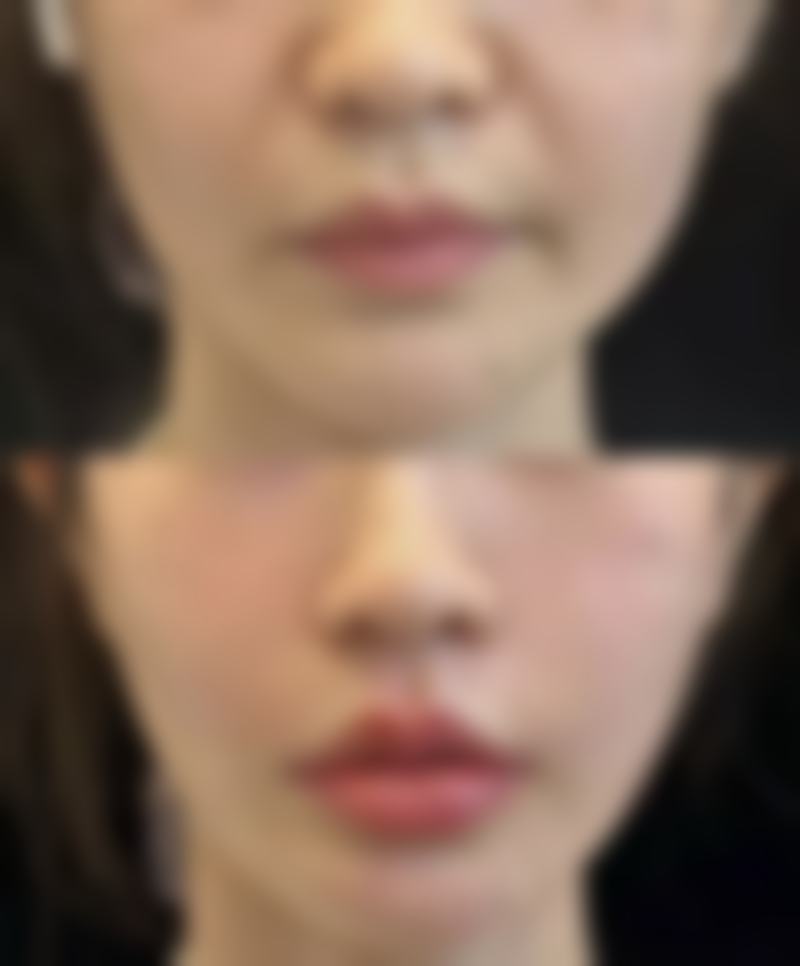 重 医附一院整形美容科医生团队,技术保护成效好