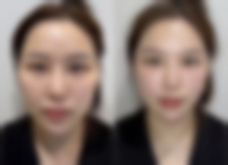 重 医附一院整形美容科价格优势,透明消费更安心