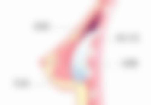 面诊当天需要准备什么