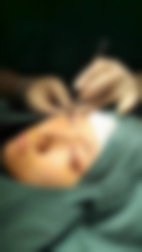 后遗症产生的原因