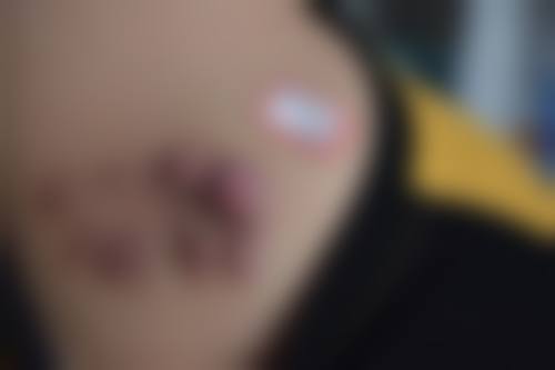 如何预约杨东运医生的手术