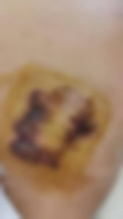 手术结果与患者反馈
