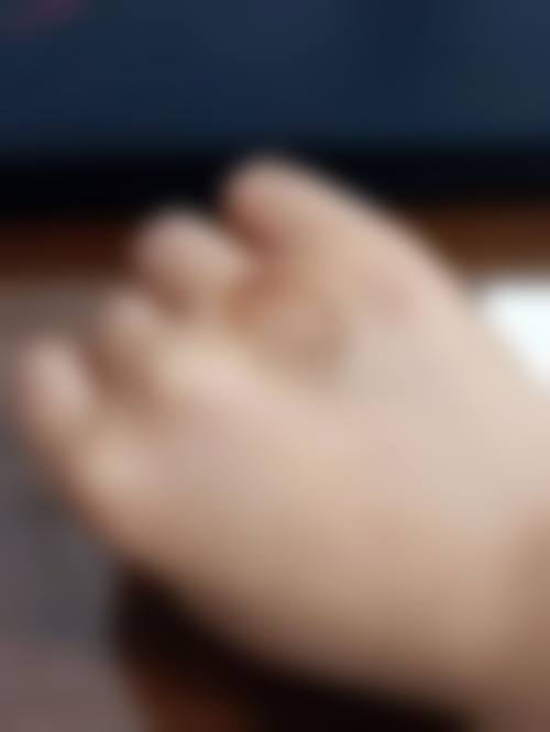 疤痕修复技术的复杂性
