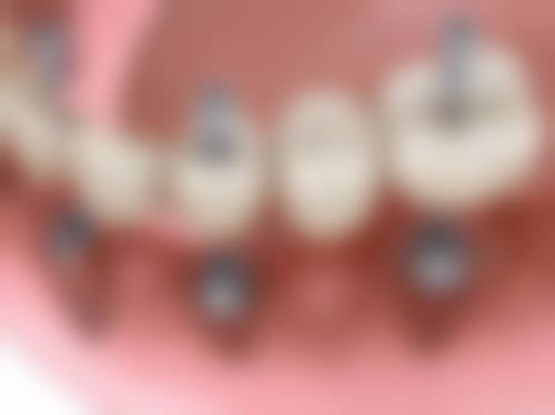 王冬平医生擅长项目