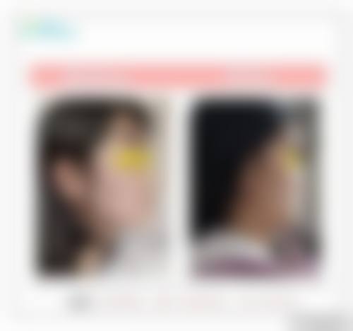 昆山艺航医疗医疗美容门诊部擅长项目。
