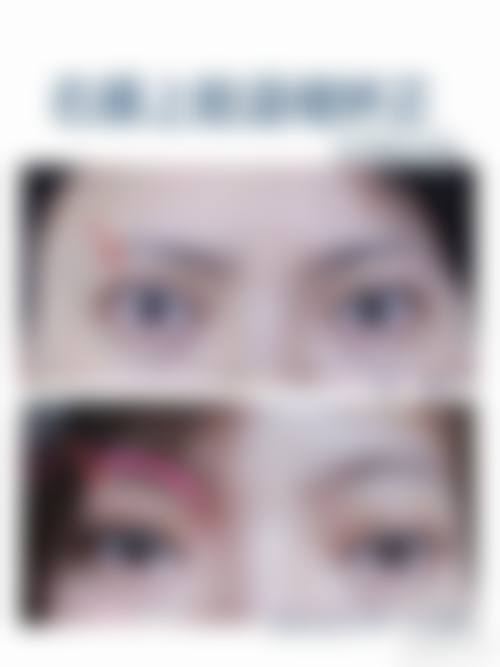 王娟医生的独特之处