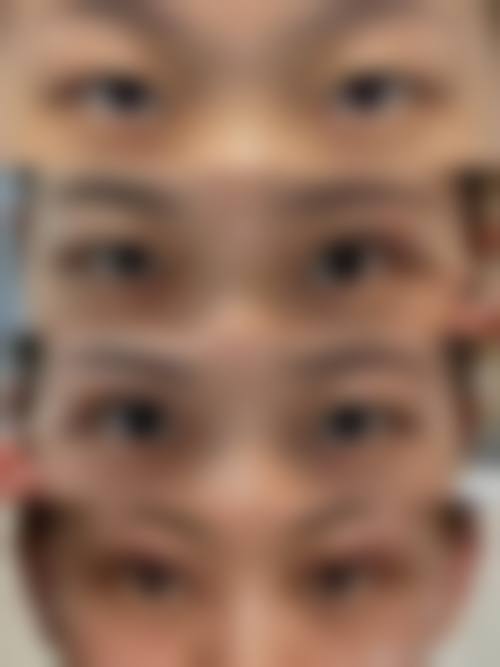 天津中 医 药大学第一附属医院眼科治疗反馈与口碑评价。