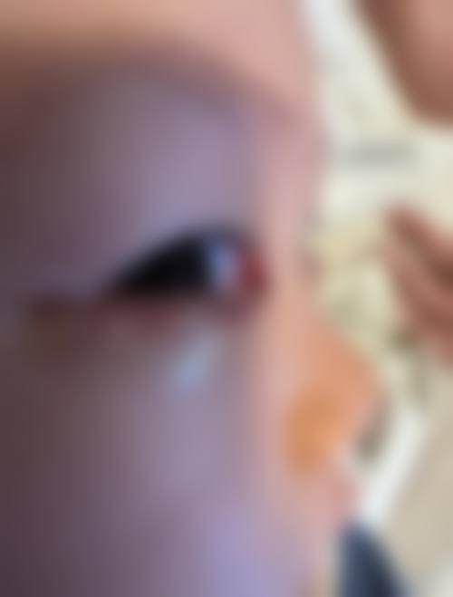 凤城爱尔眼科医院门诊营业时间。