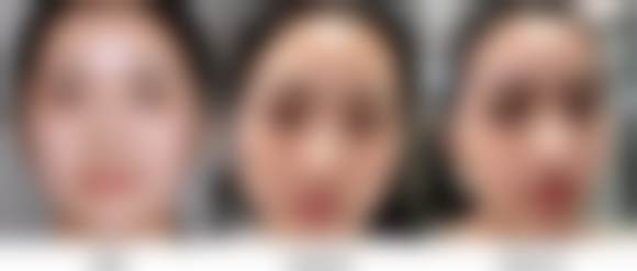 张潇潇医生口碑评价及真人实例