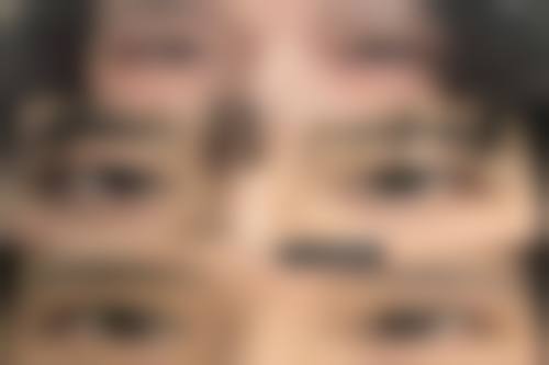 临床实例分享