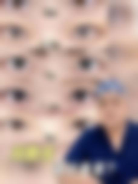 福田庆三医生双眼皮隆鼻价格