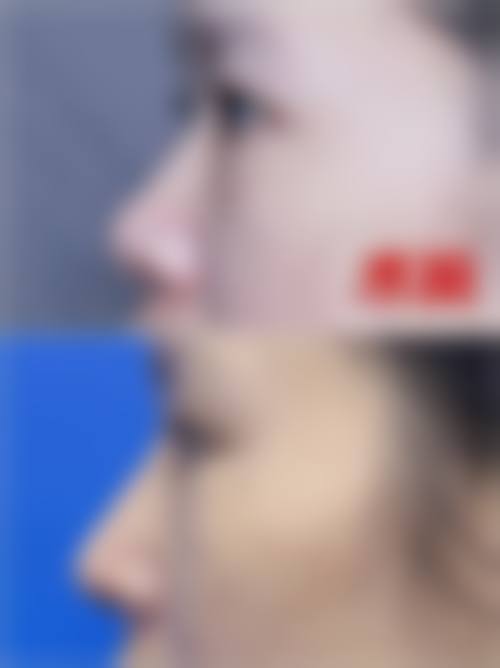 擅长项目详解
