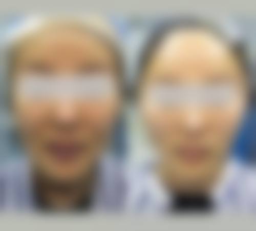 重庆叶子整形美容医院擅长项目。