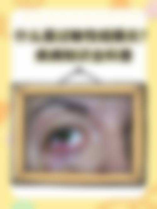 临床实例分享