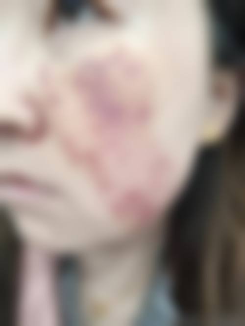 特色项目有哪些?注射美学与定制方案