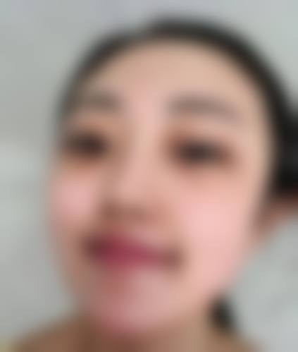 西安美人有约医学美容门诊部治疗反馈与口碑评价。