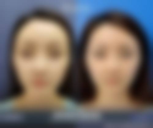 湖北十堰慕她整形预约挂号方式